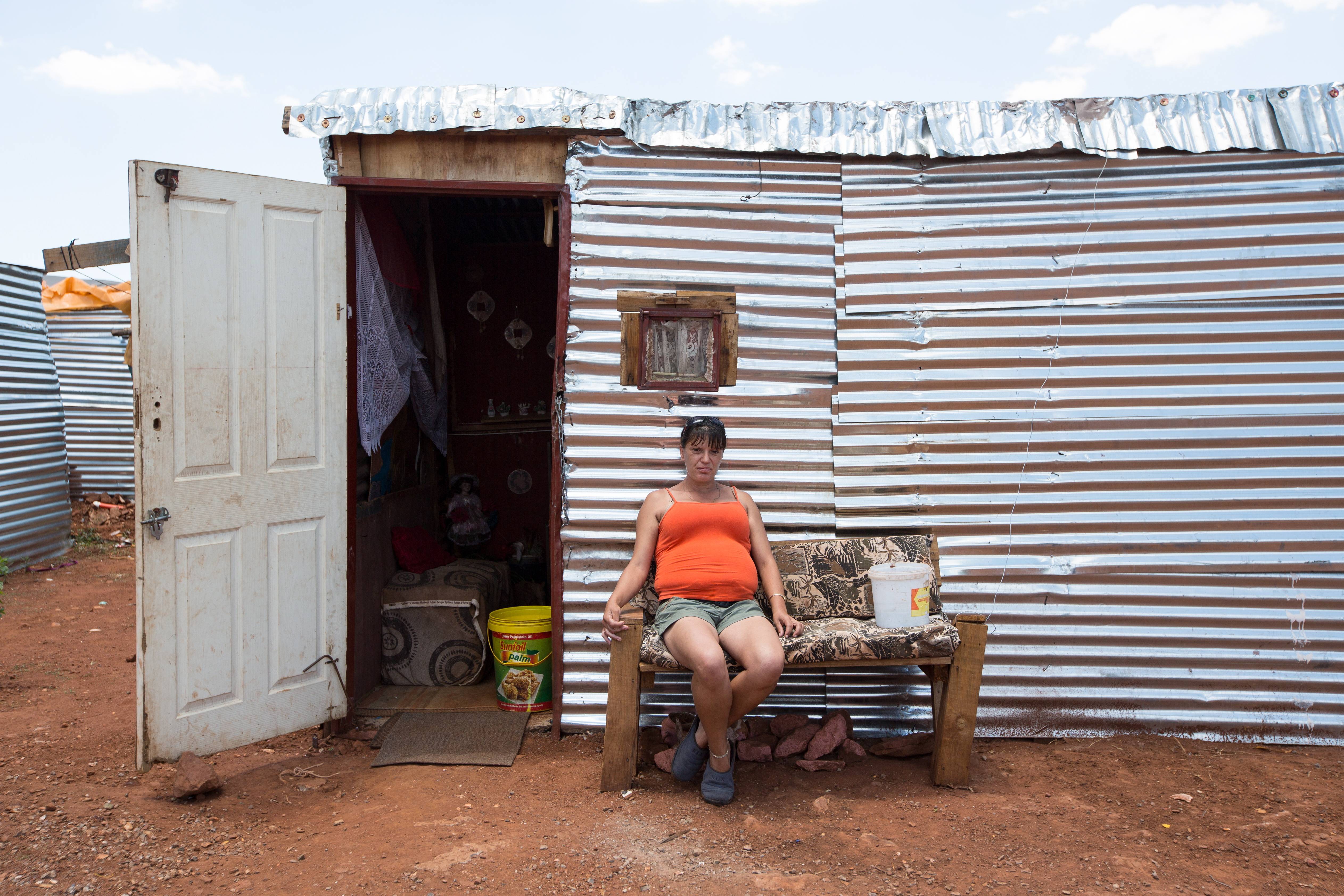 Poor White Woman in South Africa's Shanty Town